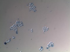 Mikroskopie von PHA-produzierenden Bakterien, Foto: Universität für Bodenkultur Wien, Institut für Umweltbiotechnologie